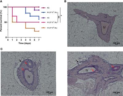 Comparative Metabolomics and Proteomics Reveal Vibrio parahaemolyticus Targets Hypoxia-Related Signaling Pathways of Takifugu obscurus